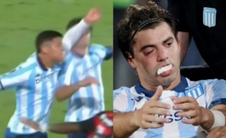 El tremendo codazo de Rojo a Sosa que genera gran preocupación en Racing