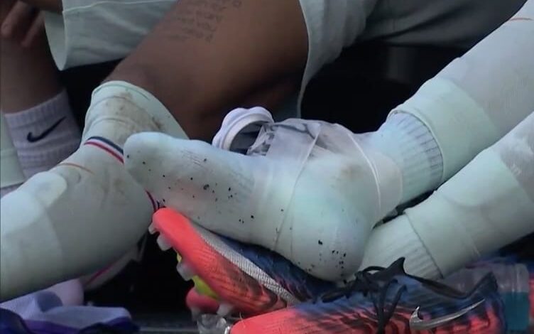Kylian Mbappé CON HIELO en su tobillo tras pedir el cambio ante Marruecos